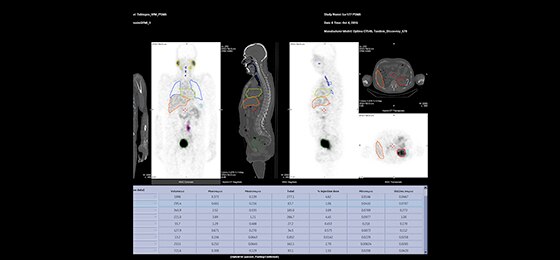 $name | GE Healthcare (Turkey)