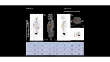$name | GE Healthcare (Turkey)