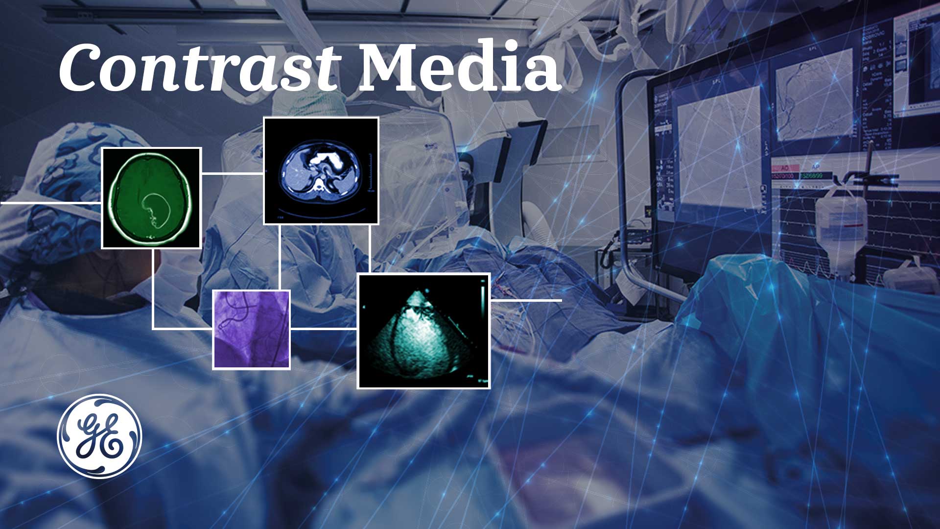 Classification of Contrast Medium Rit, Omniscan, Urograffin, Omnipaque