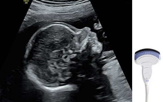 GE Healthcare C1-5RS Probu