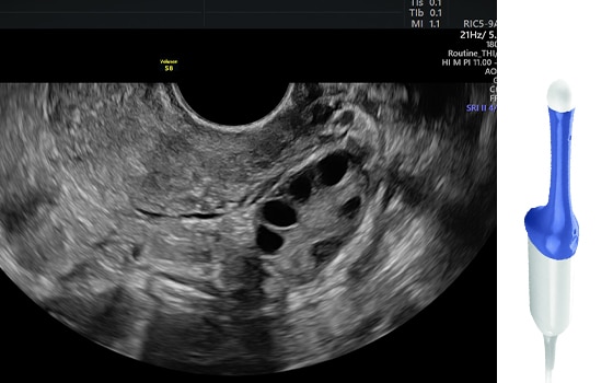 GE Healthcare RIC5-9-RS Probu