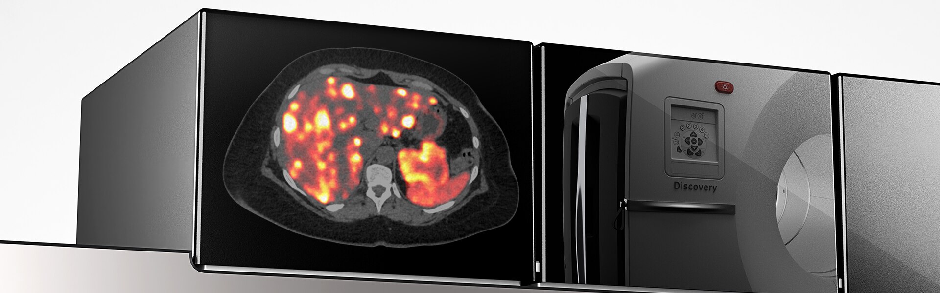 GEHCDMIG2ProductWebPageBenefitsSummaryImage1