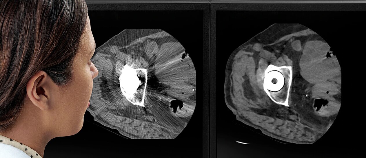 GEHCRevolutionMaximaProductWebPagePostScanImage1