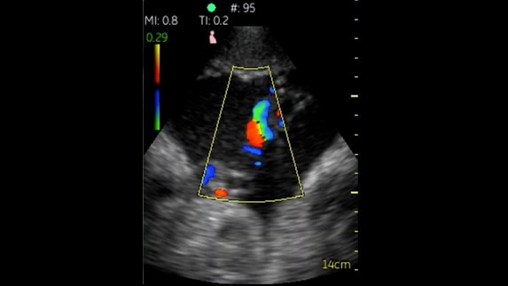 hotspot tours-vscan-umbilical-cord-with-color-flow_jpg