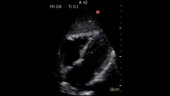 hotspot tours-vscan-cardiac-subcostal_jpg