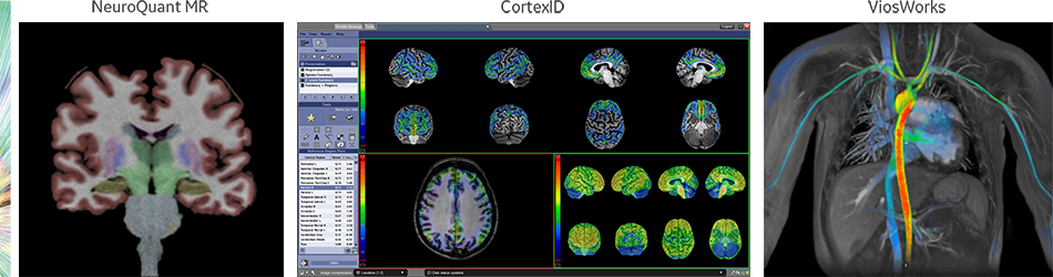 product-product-categories-magnetic-resonance-imaging-signa petmr-Organ.png