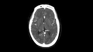 N�roloji G�r�nt� Galerisi