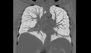 V�cut G�r�nt� Galerisi