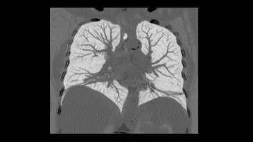 Vücut Görüntü Galerisi