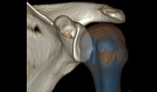 Kas-�skelet G�r�nt� Galerisi