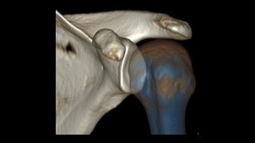 Kas-İskelet Görüntü Galerisi