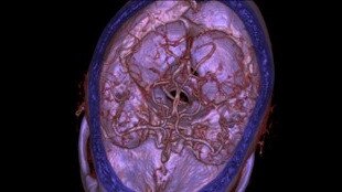 Vask�ler G�r�nt� Galerisi