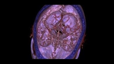 Vasküler Görüntü Galerisi