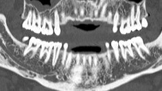 ileri görüntüleme dentascan plus.