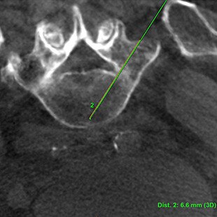 ct-categories-interventional-x-ray-igs-for-hybrid-or-discovery igs 730-needle-assist-1.jpg