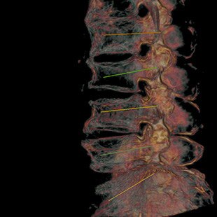 ct-categories-interventional-x-ray-igs-for-hybrid-or-discovery igs 730-needle-assist-3.jpg