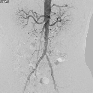 ct-categories-interventional-x-ray-igs-for-hybrid-or-discovery igs 730-vessel-assist-1.jpg