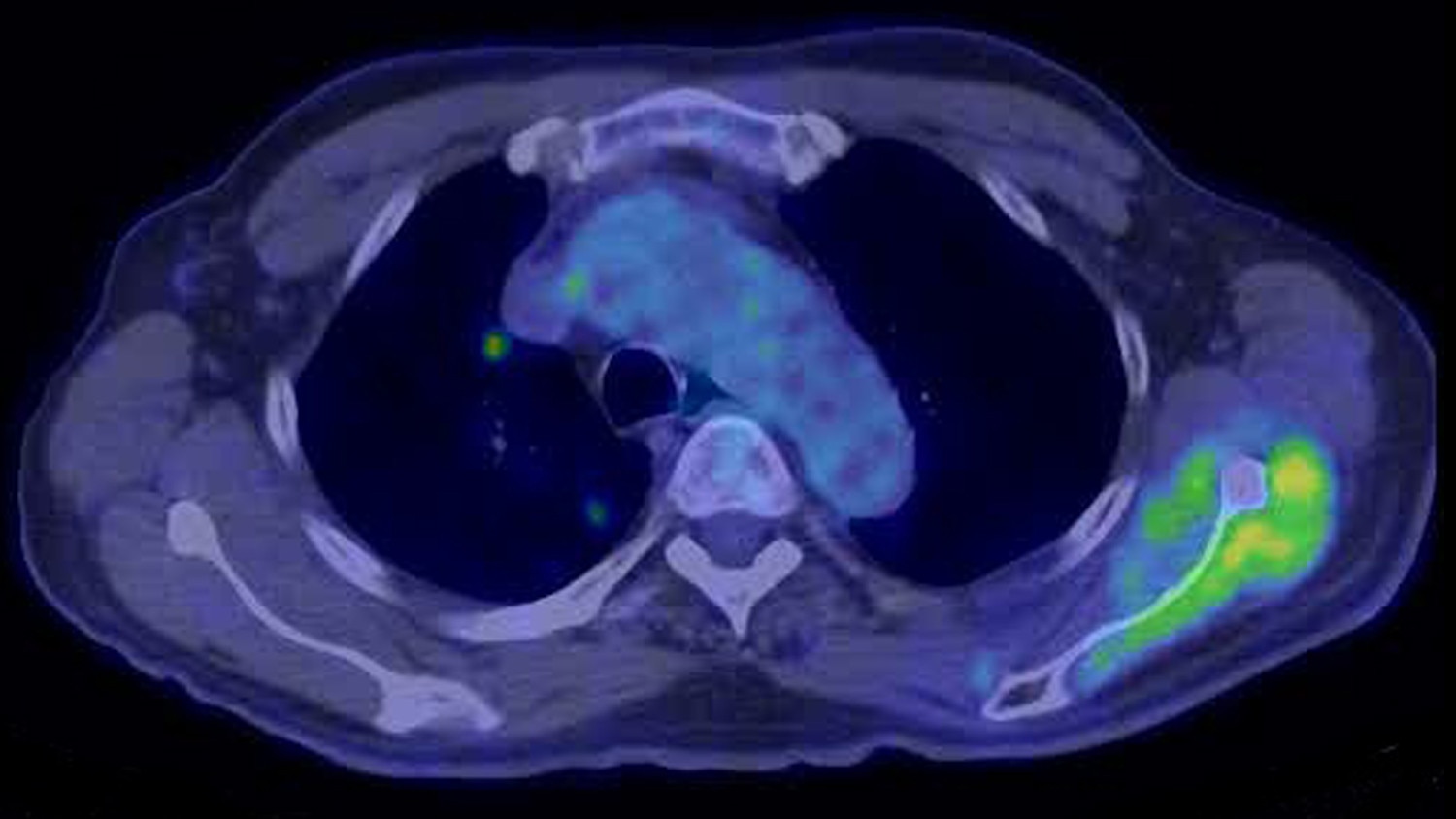 product-product-categories-pet-ct-qclear-gehc-qclear-case2_thumbnail.jpg