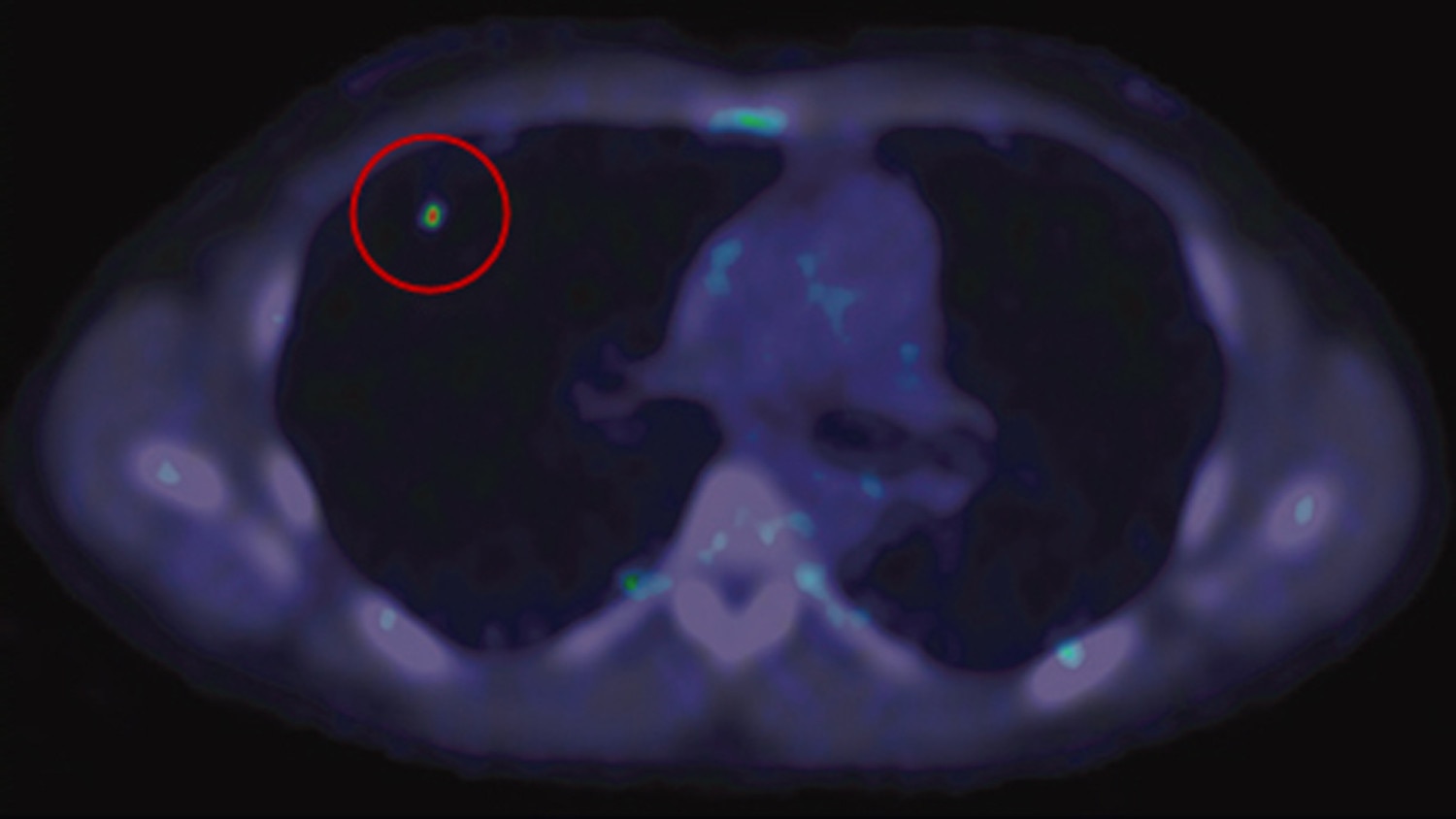 product-product-categories-pet-ct-qclear-gehc-qclear-clinical-image1-thumbnail.jpg