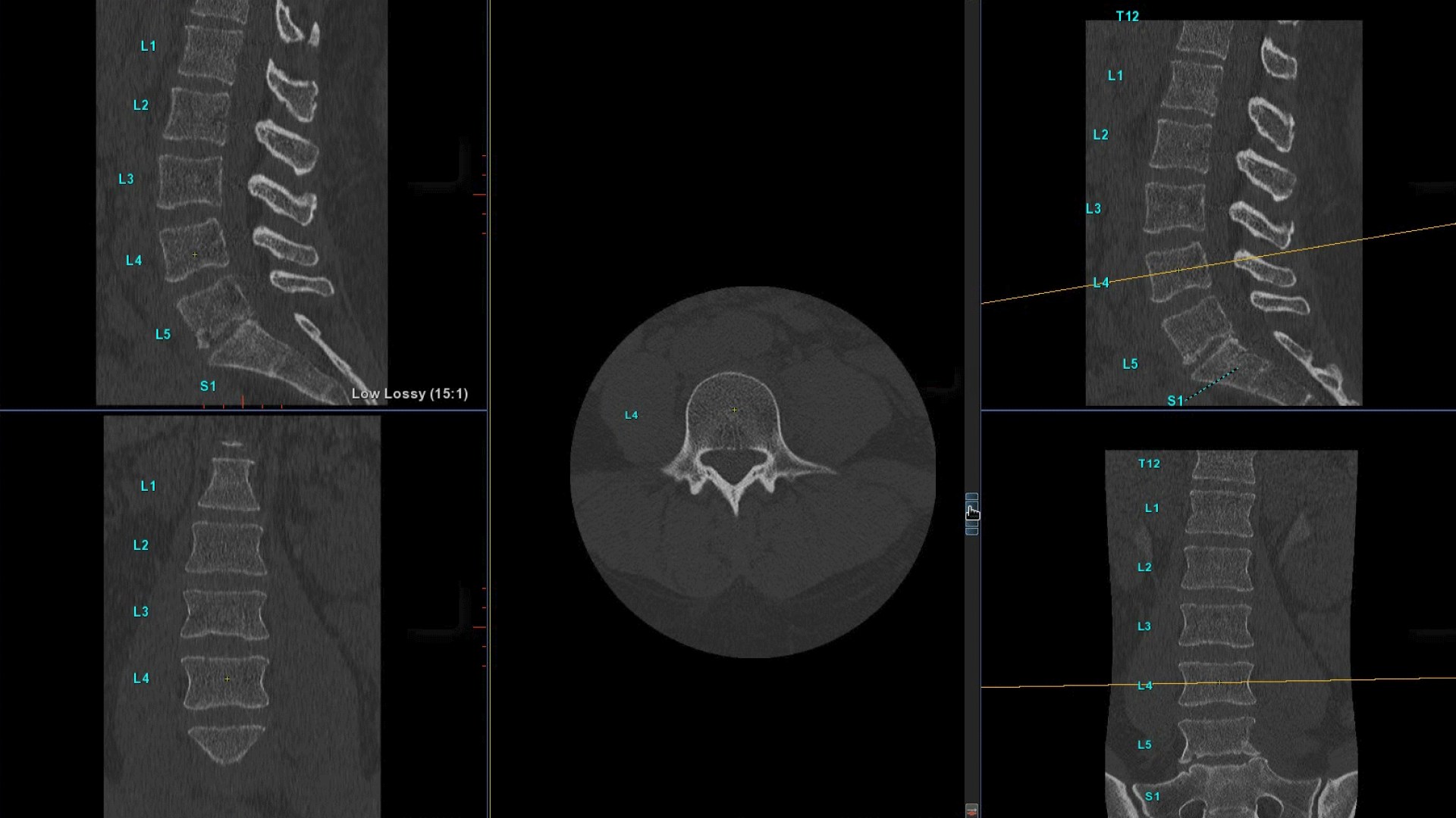 Product Media Carousel Image