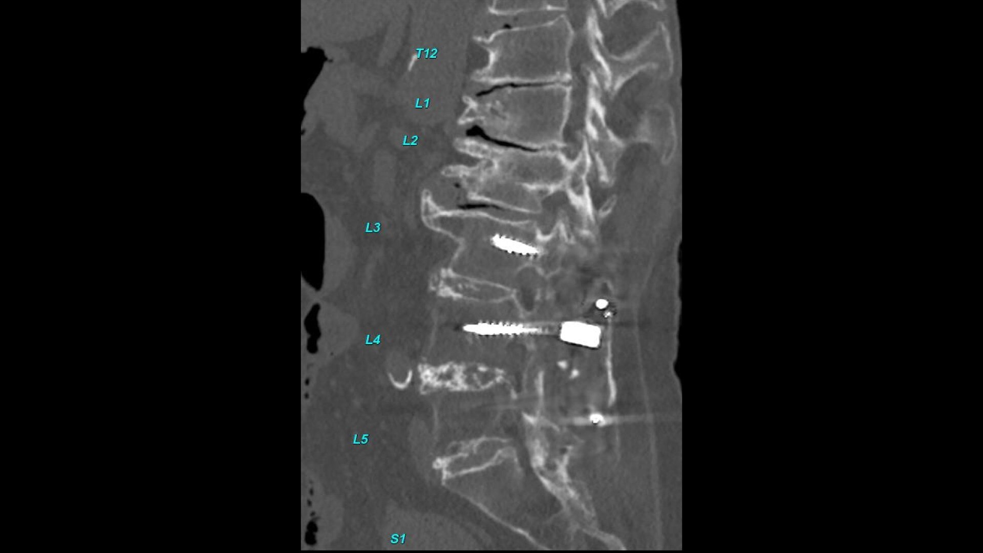 Product Media Carousel Image