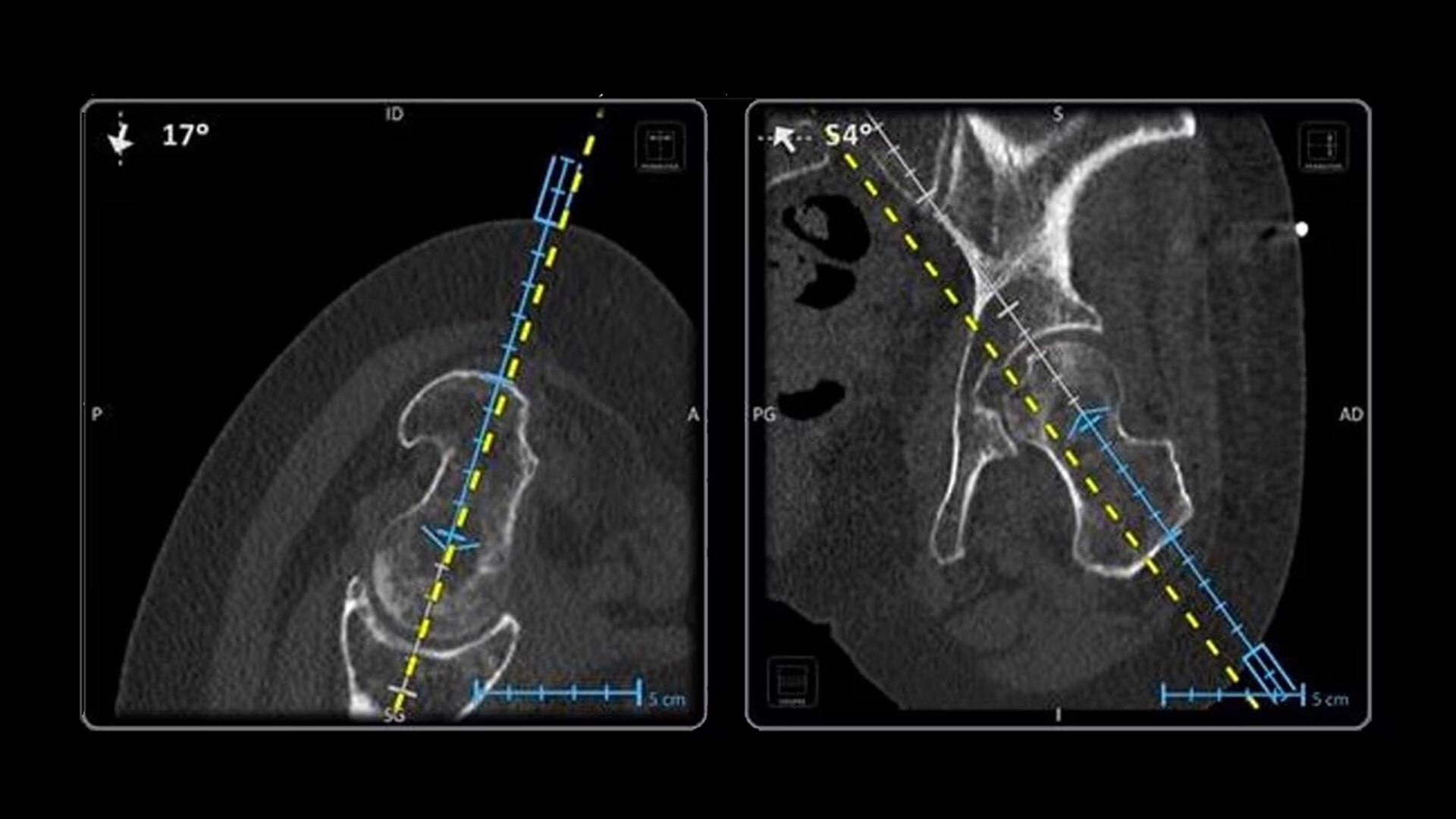 Product Media Carousel Image