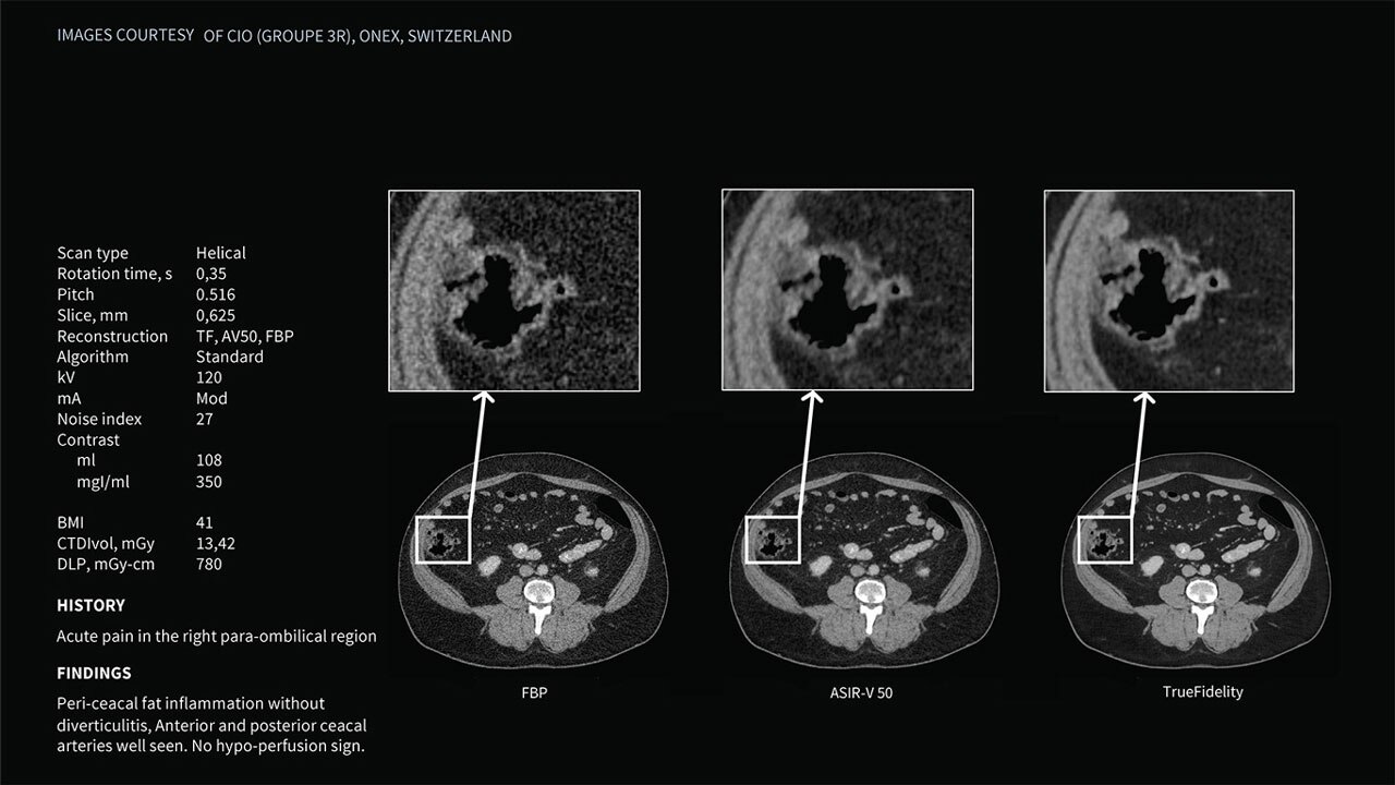 Product Media Carousel Image