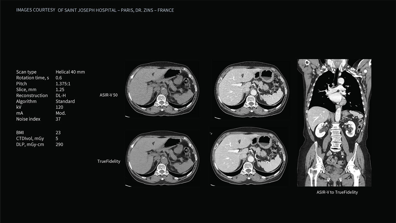 Product Media Carousel Image
