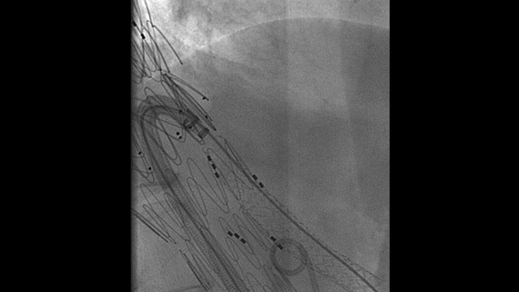 Product Media Carousel Image