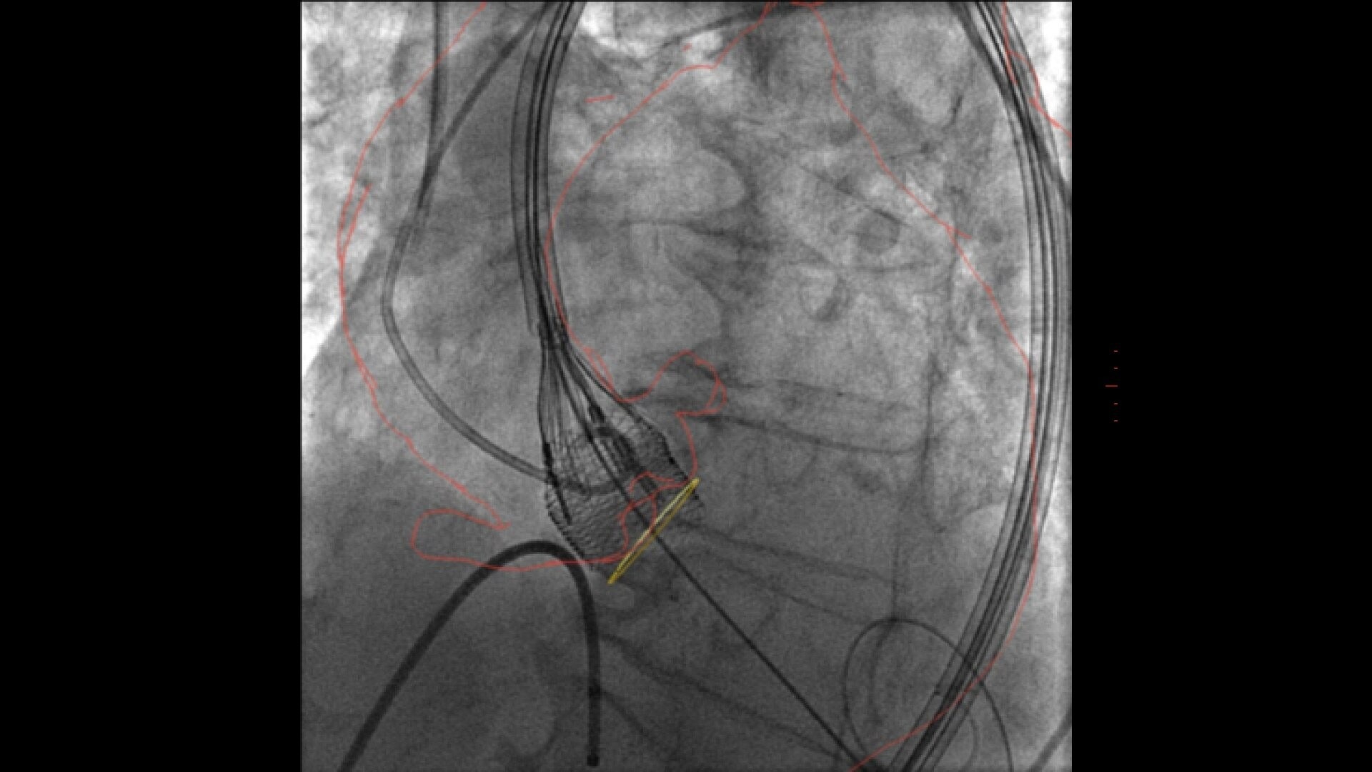 Product Media Carousel Image