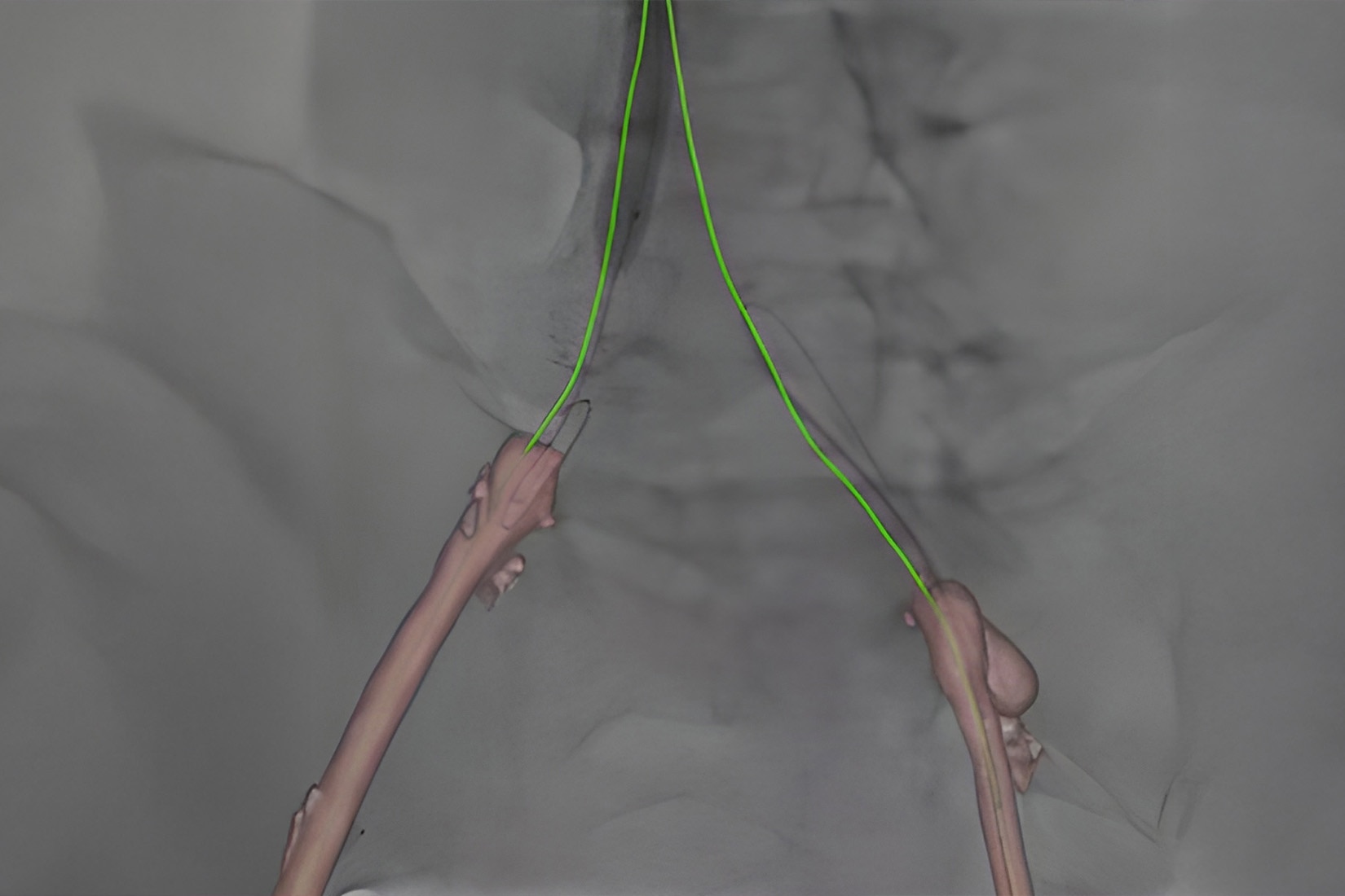 Product Media Carousel Image