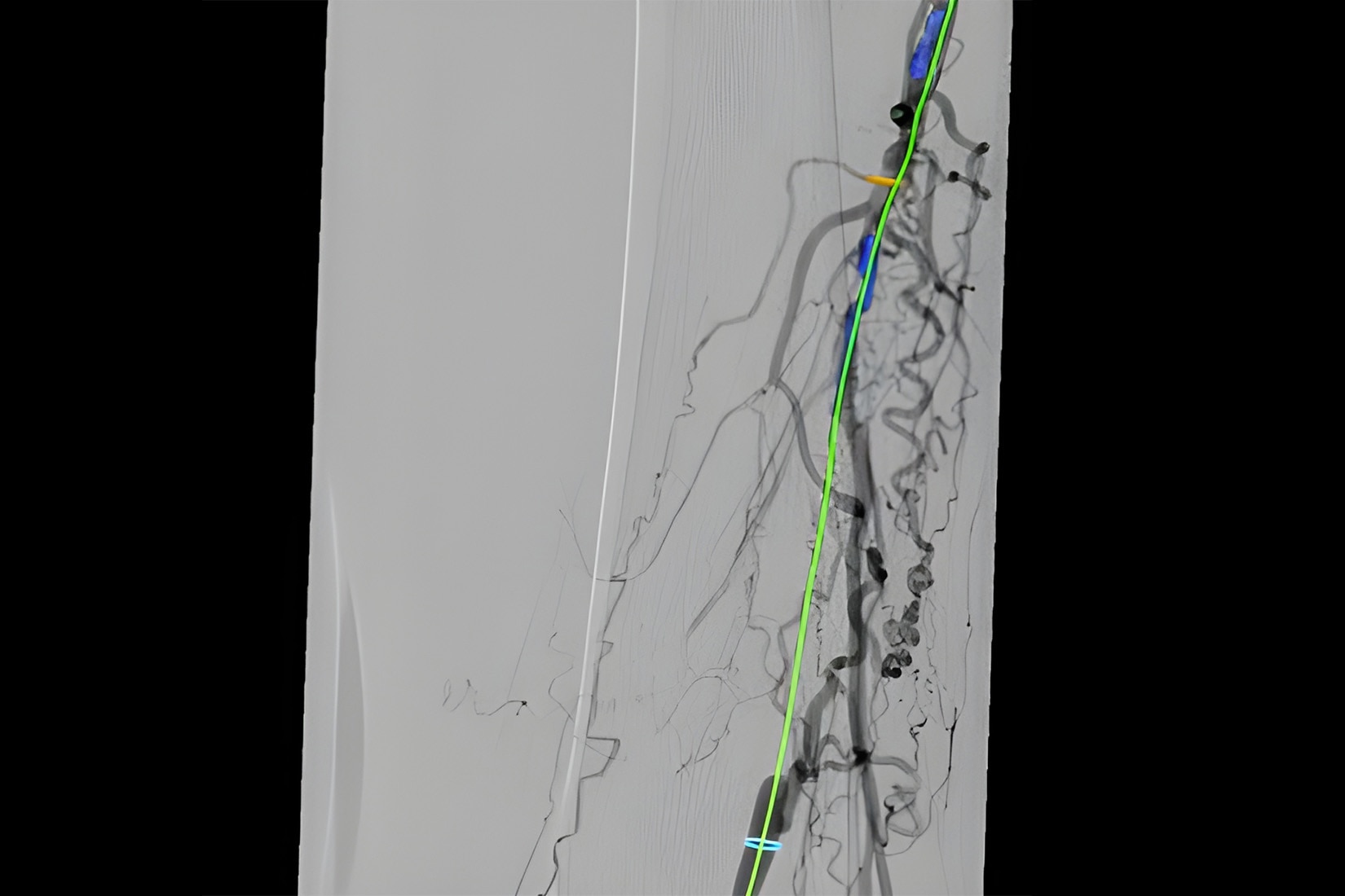 Product Media Carousel Image