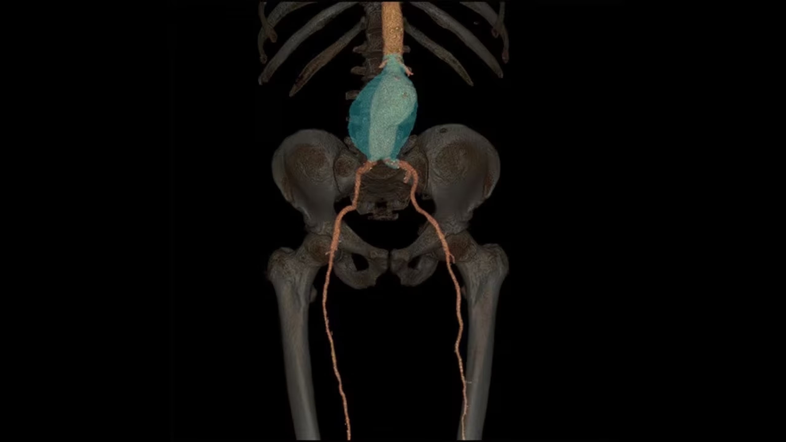 Product Media Carousel Image