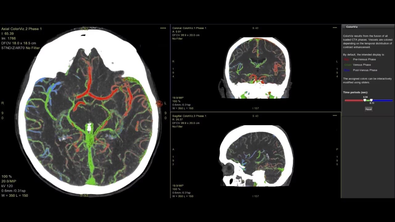 Product Media Carousel Image