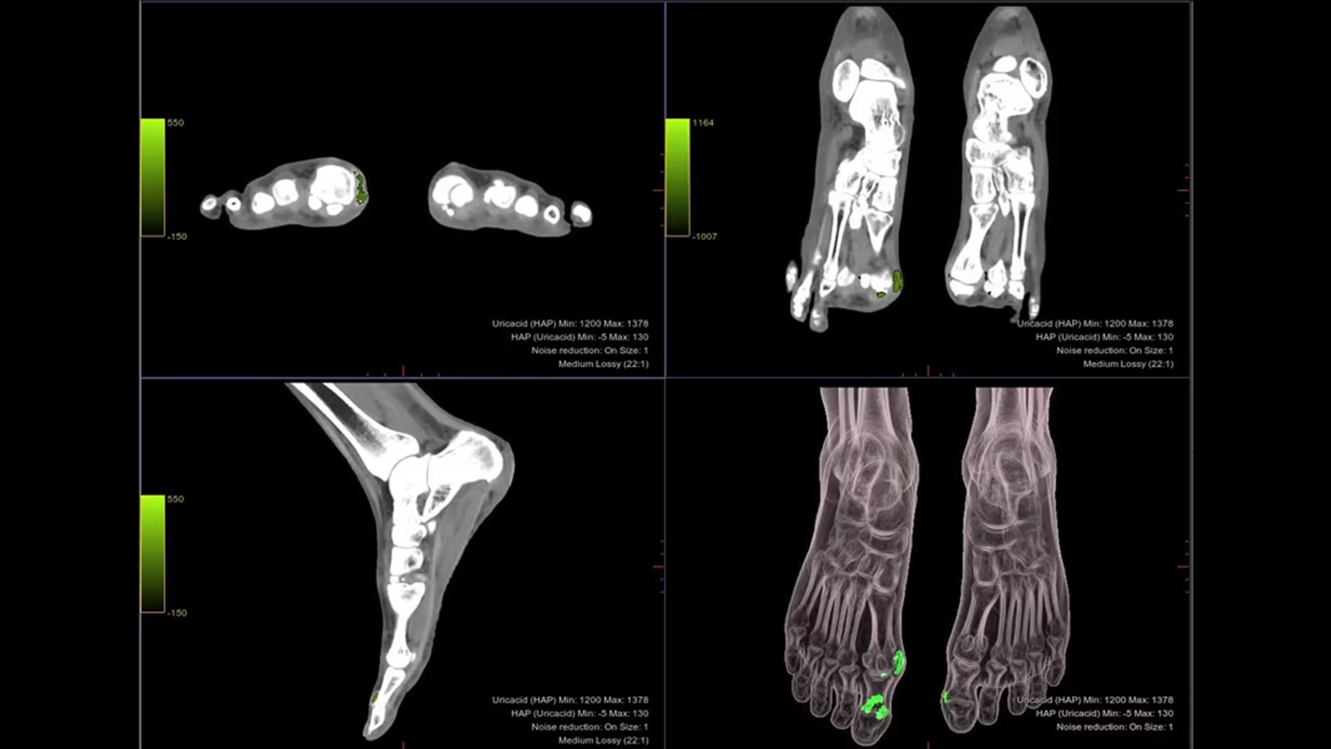 Product Media Carousel Image