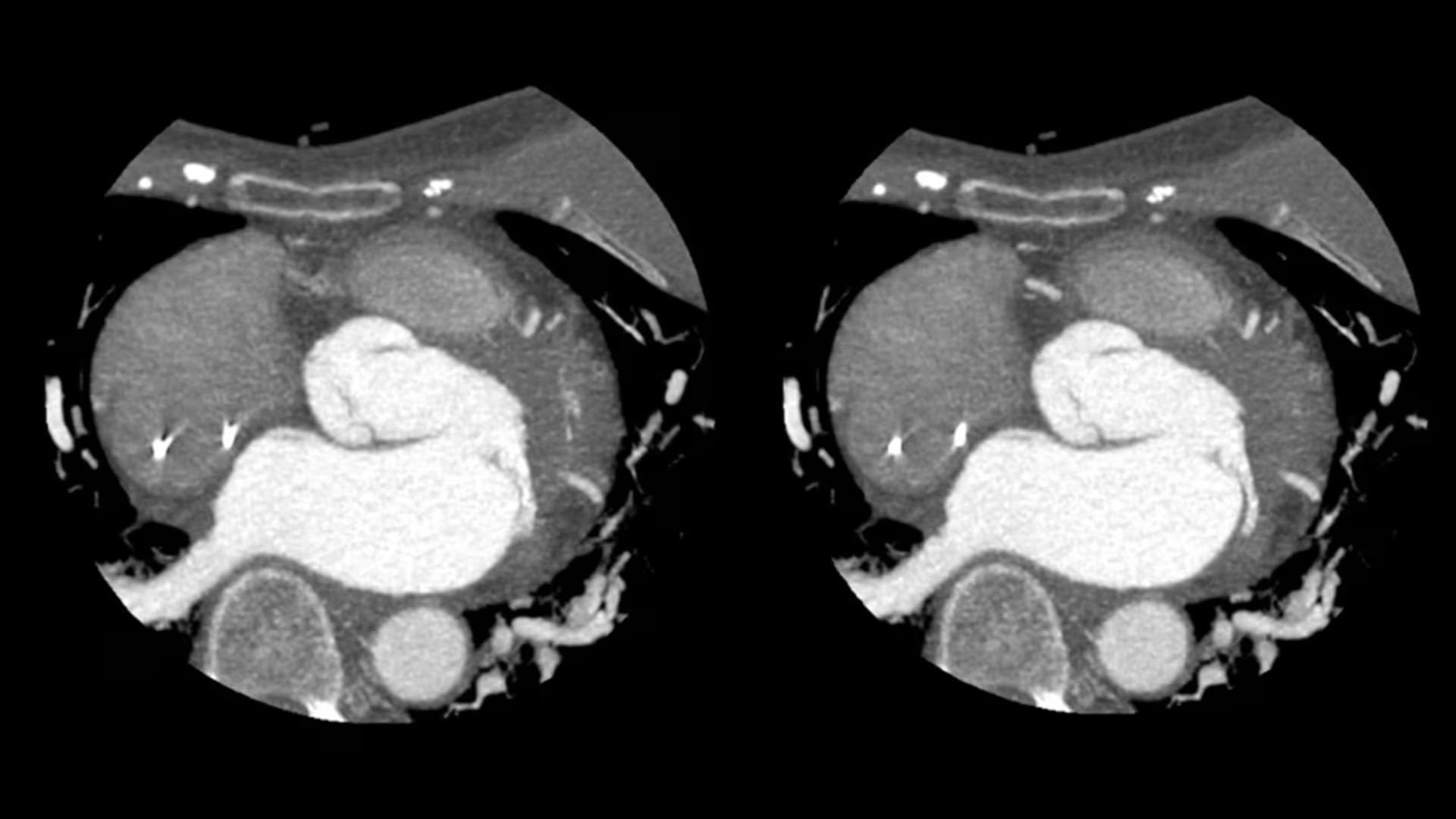 Product Media Carousel Image