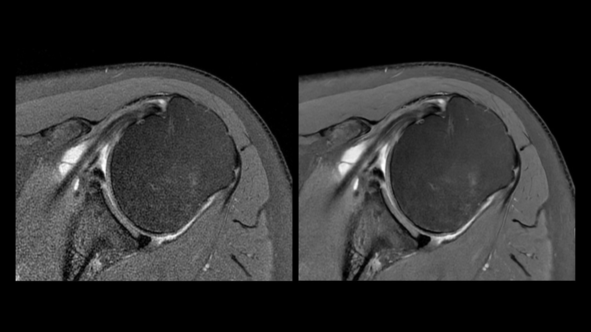 Product Media Carousel Image
