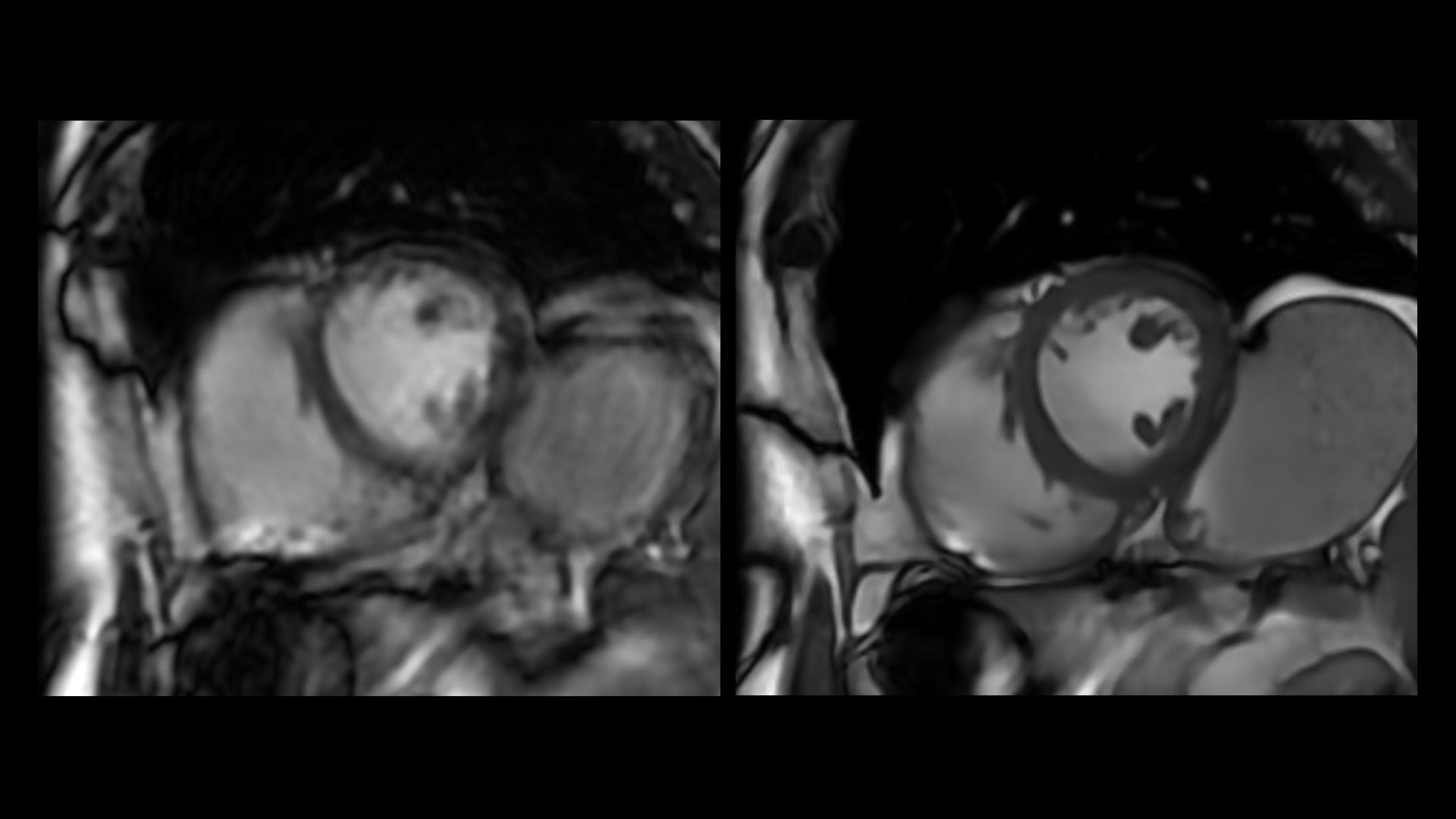 Product Media Carousel Image