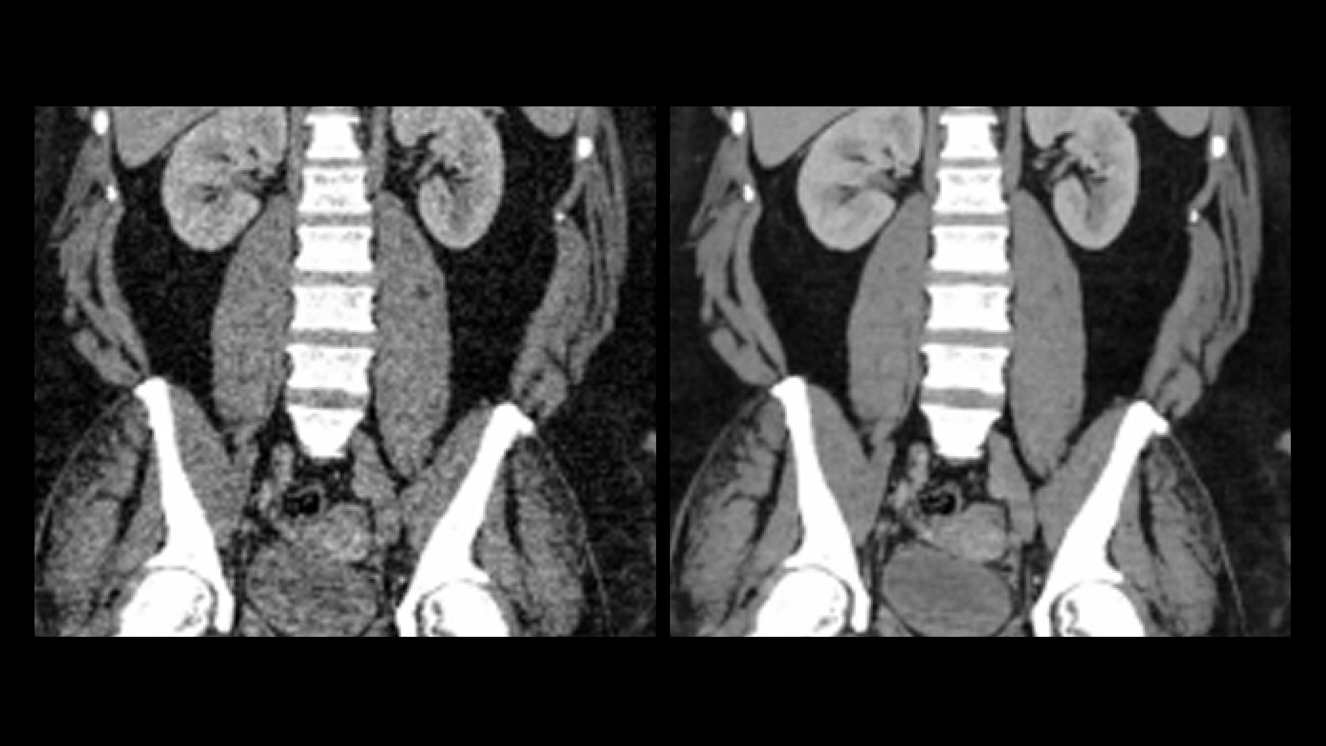 Product Media Carousel Image
