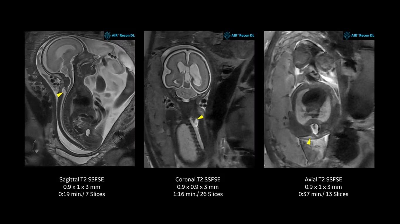 Product Media Carousel Image