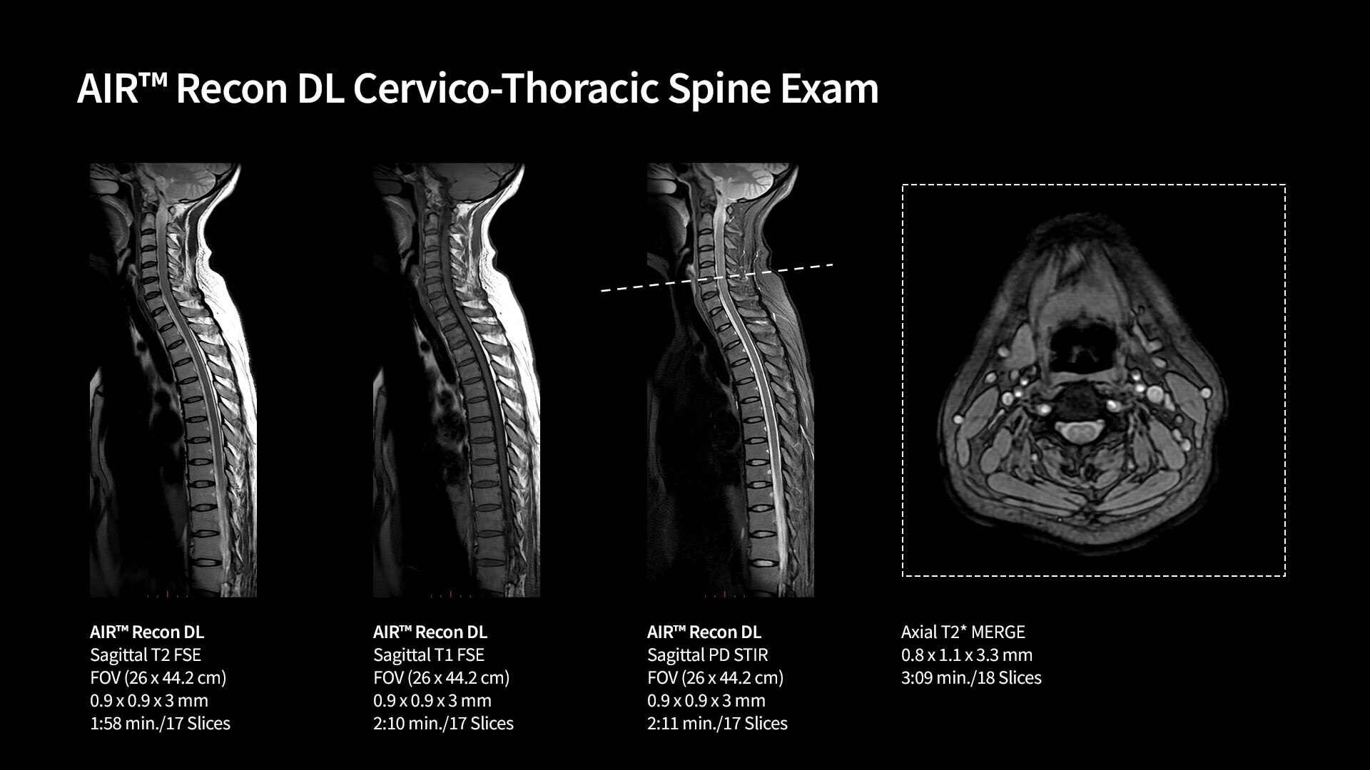 Product Media Carousel Image