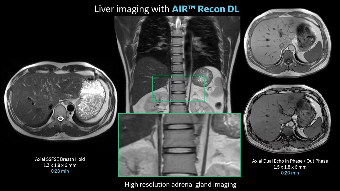 Product Media Carousel Image