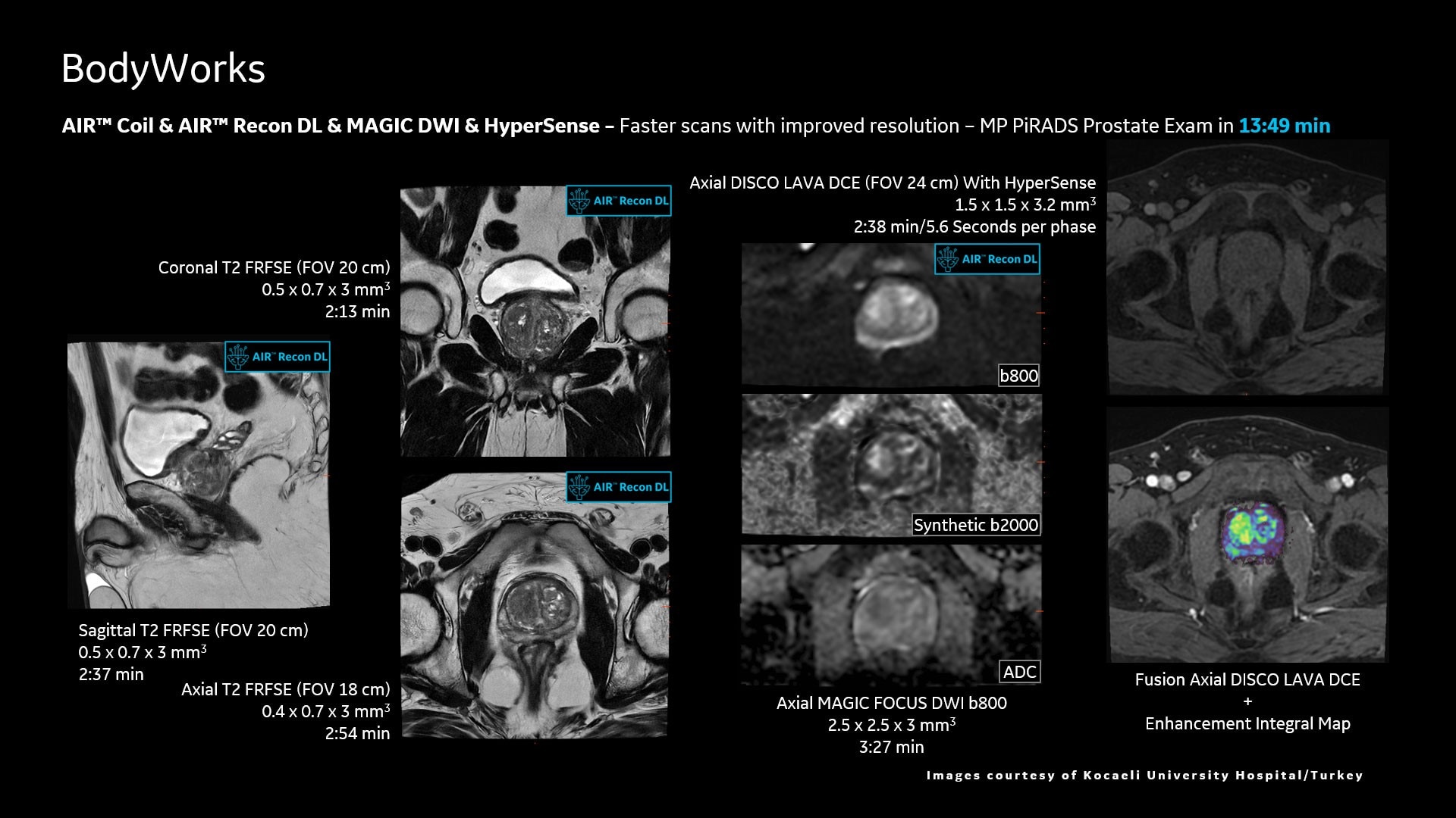 Product Media Carousel Image