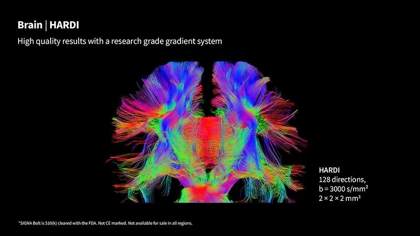 Product Media Carousel Image