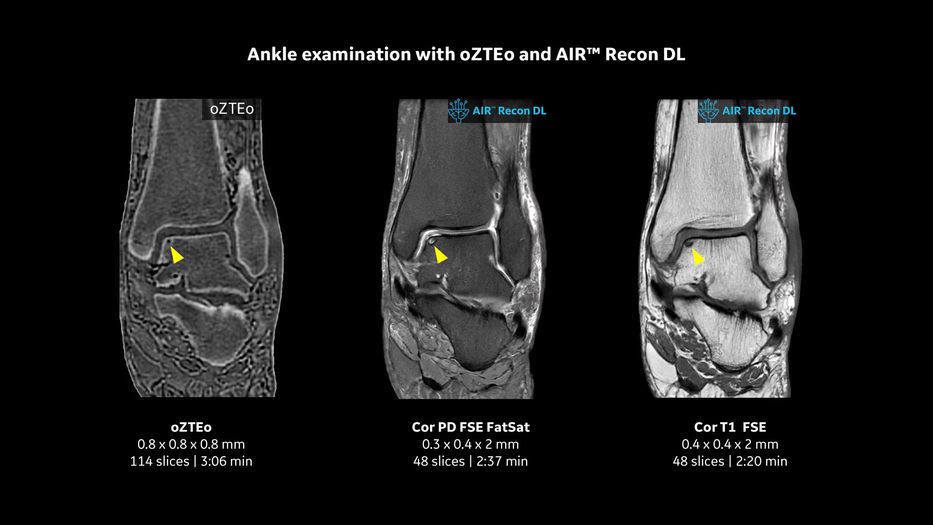 Product Media Carousel Image