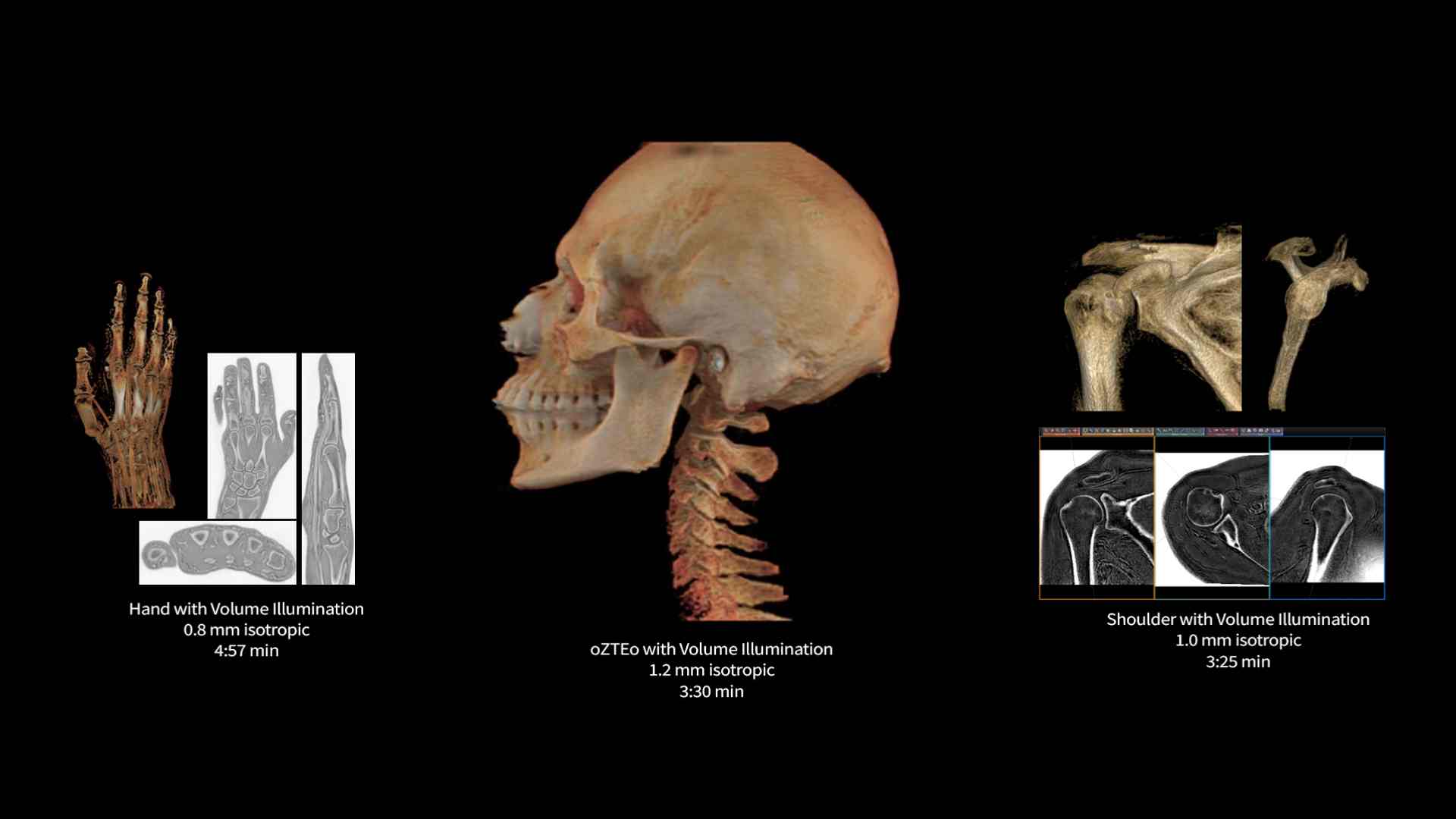 Product Media Carousel Image