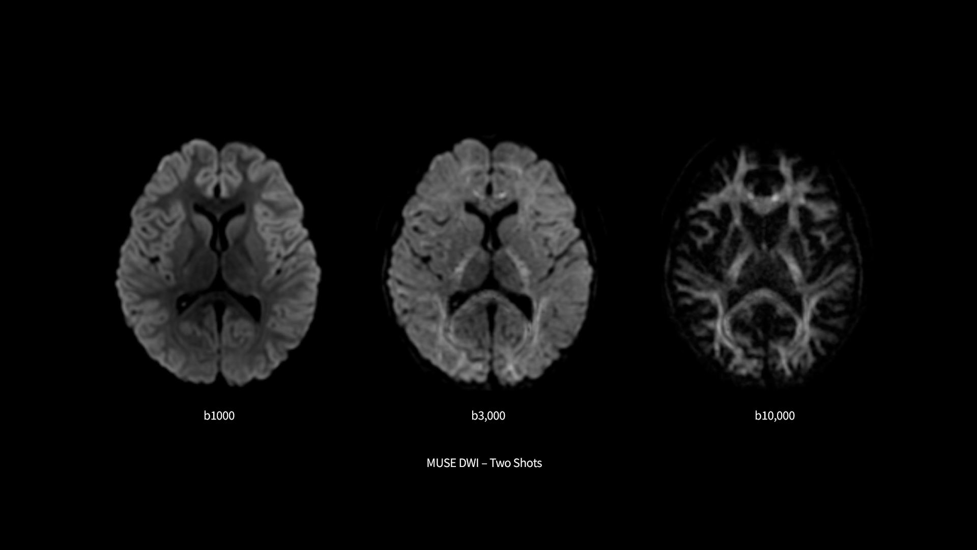 Product Media Carousel Image