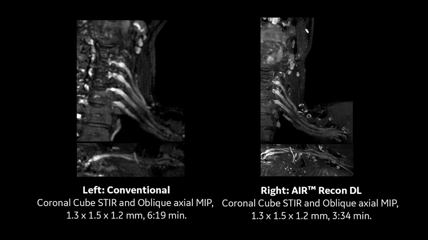 Product Media Carousel Image