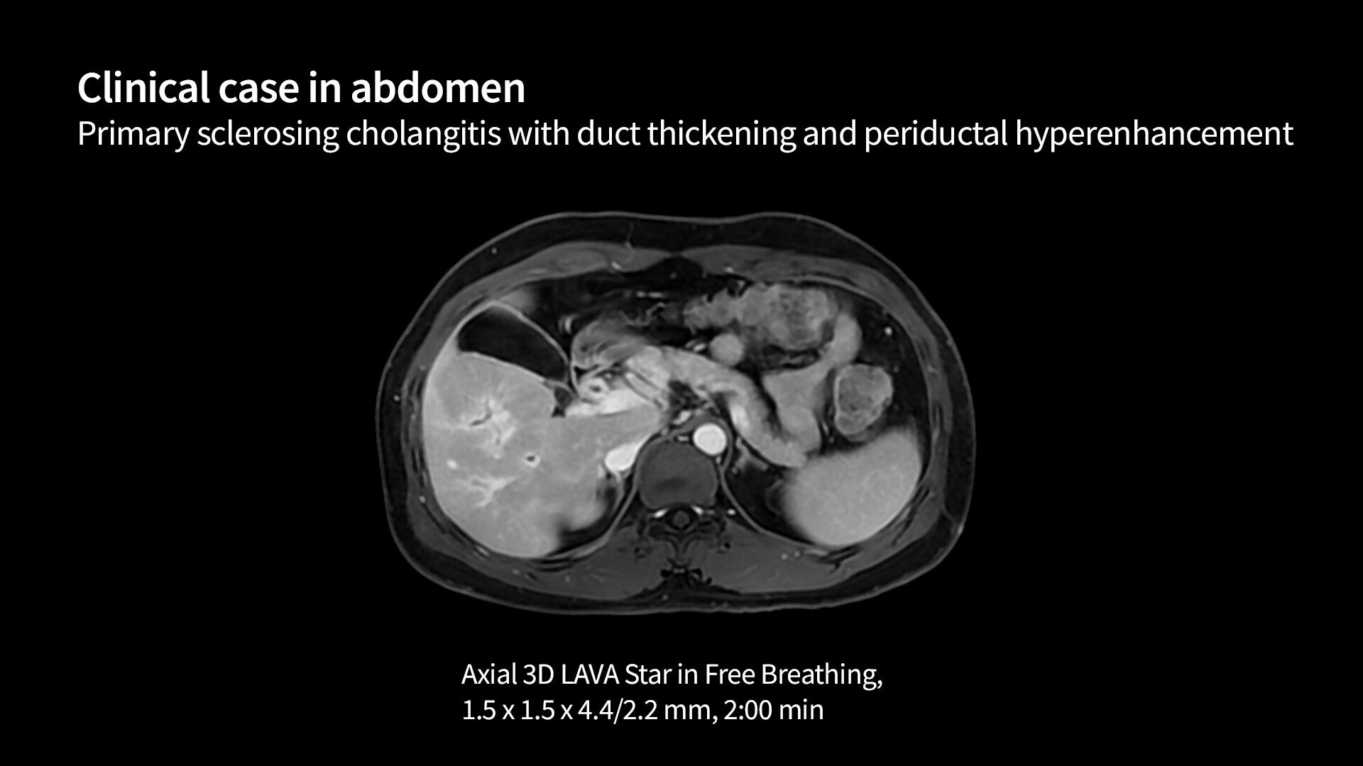 Product Media Carousel Image