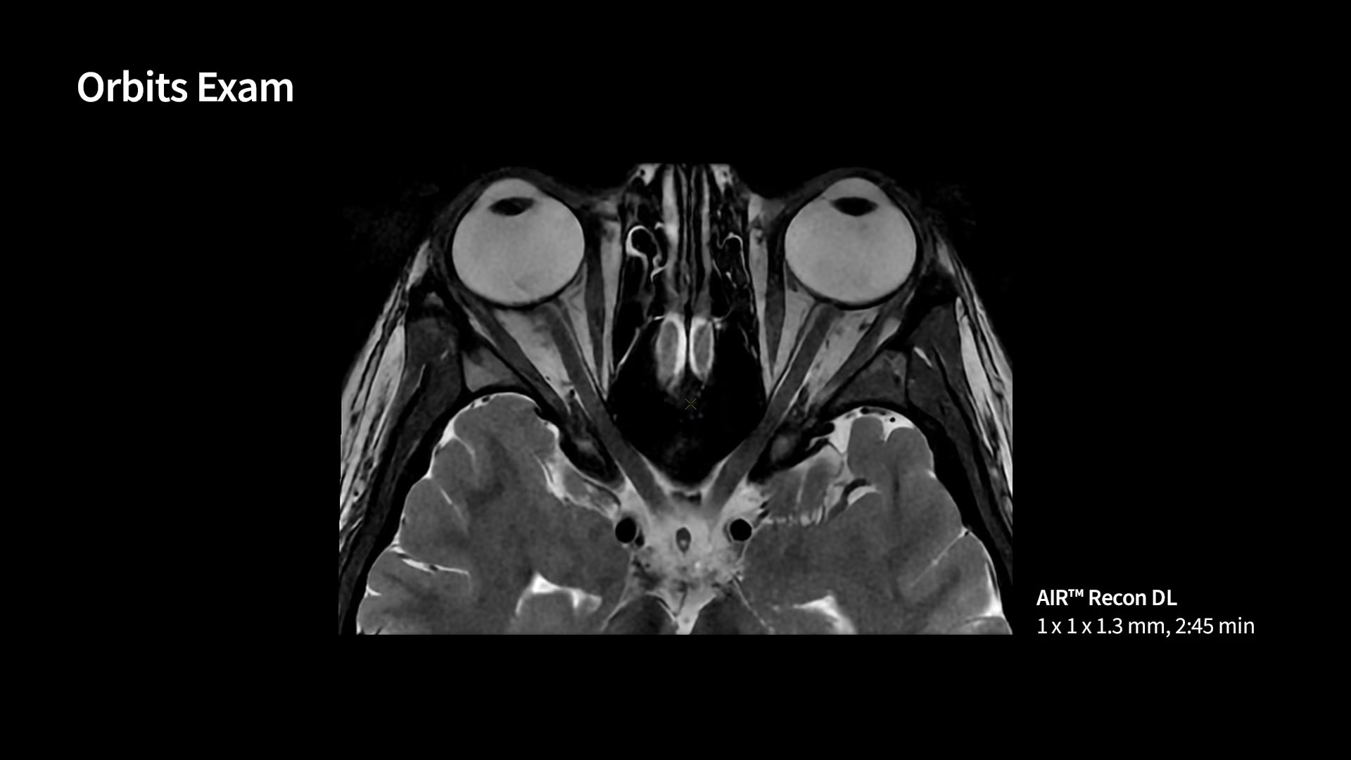 Product Media Carousel Image